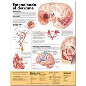  Understanding Stroke in Spanish Chart/Poster
