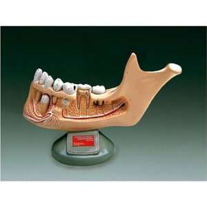  Deluxe Jaw With Removable Teeth
